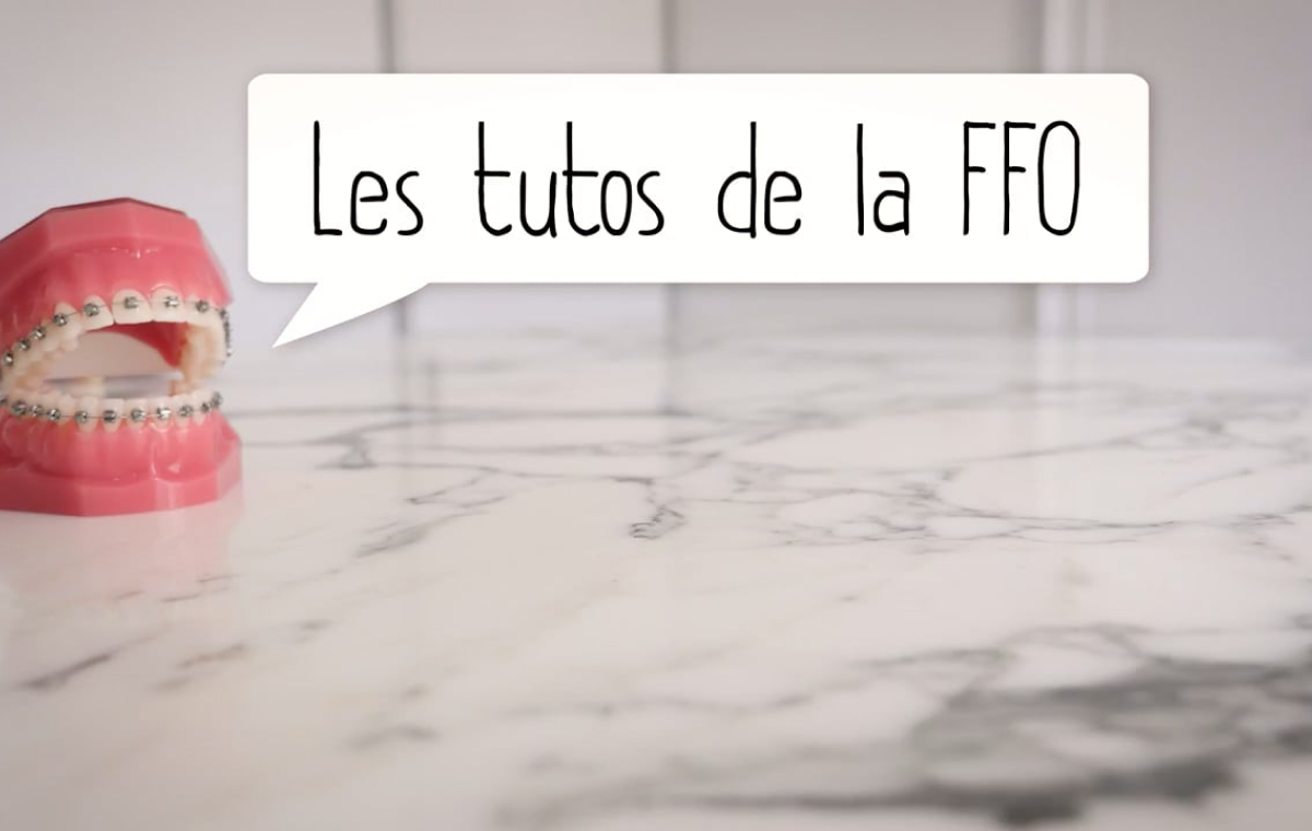 Comment éviter de casser son appareil